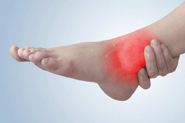 تاندونیت آشیل